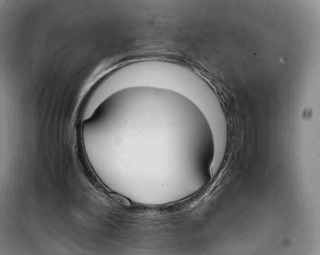 X0000099400198200806051215