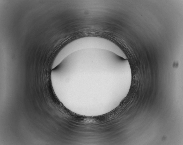 X0000099400218200806051215