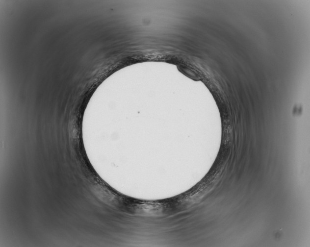 X0000099400317200806051213