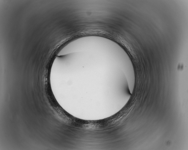 X0000099400356200806051213