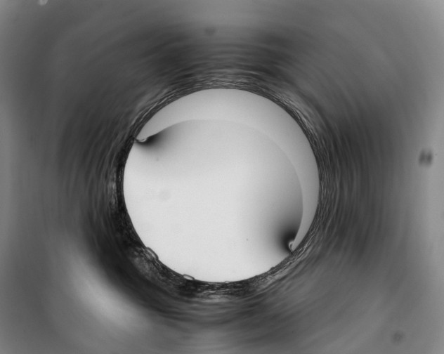 X0000099400381200806051213