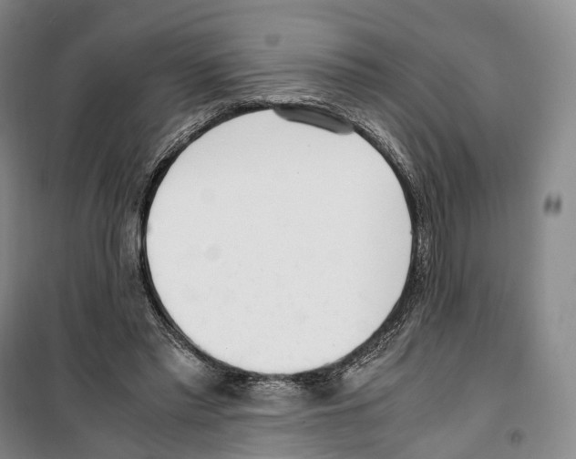 X0000099400397200806051212
