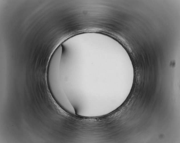 X0000099401186200806051201