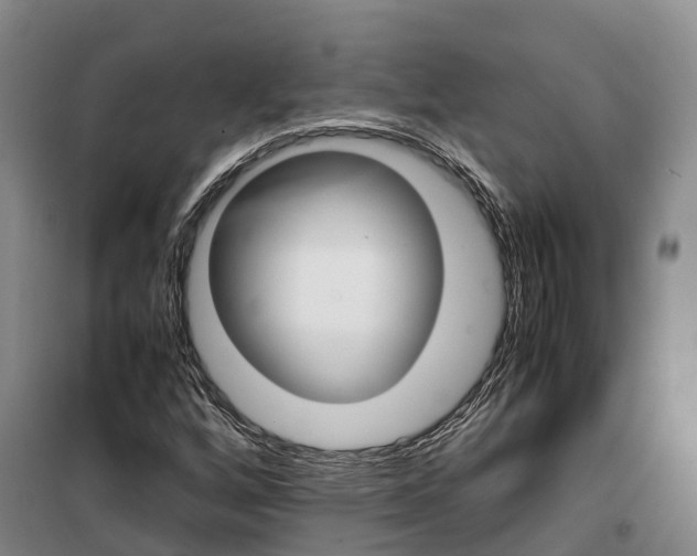 X0000099401256200806051159