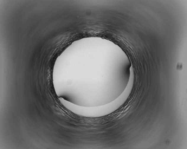X0000099401299200806051158