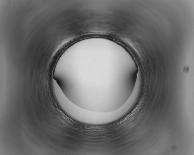 X0000099401307200806051158