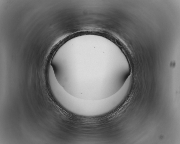 X0000099401315200806051158