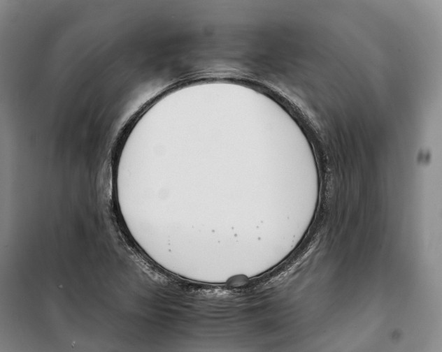X0000099401317200806051159