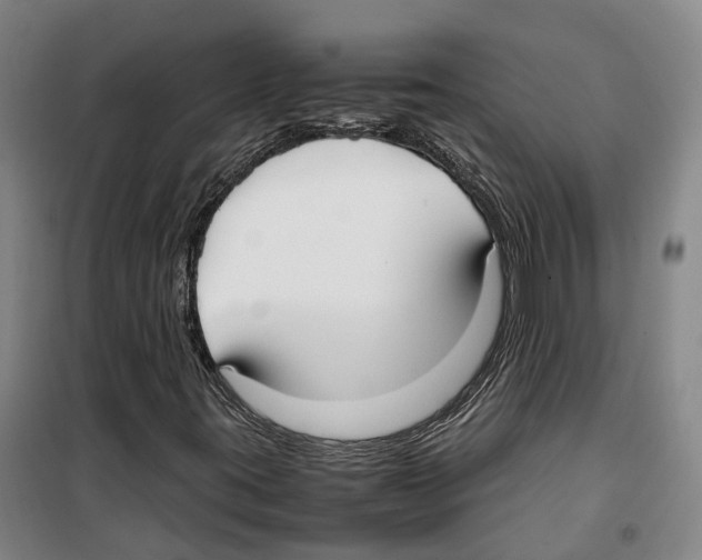 X0000099401395200806051157