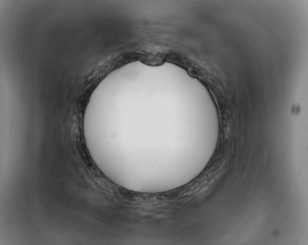 X0000099401397200806051157
