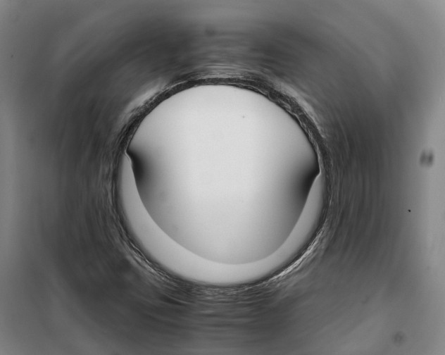 X0000099401403200806051157