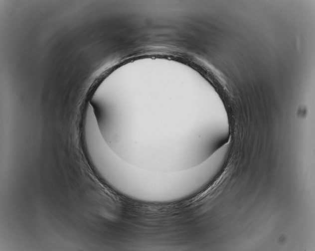 X0000099401411200806051157