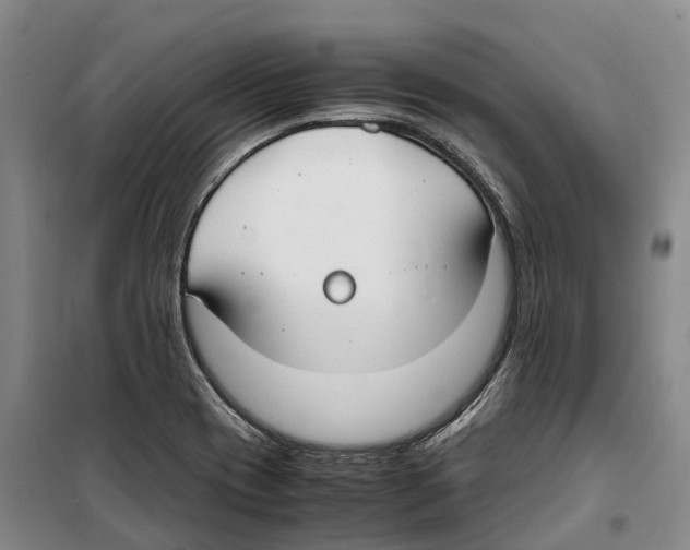 X0000099401417200806051157