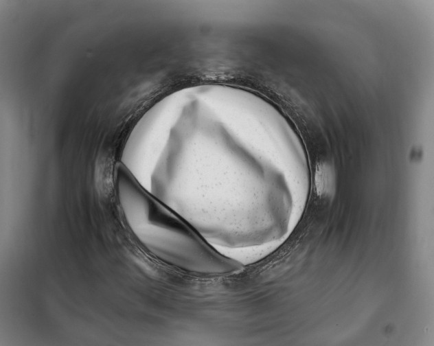 X0000099401444200806051156