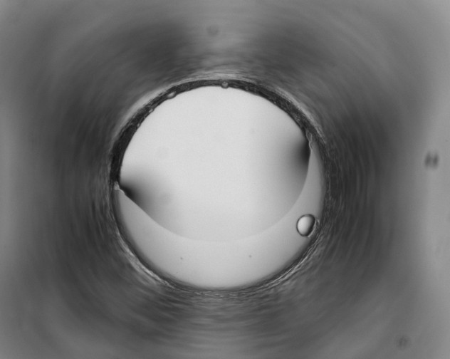 X0000099401452200806051156