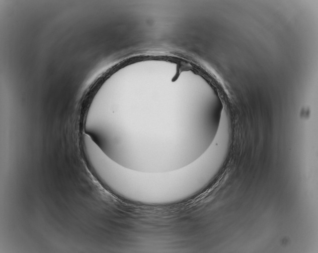 X0000099401456200806051156