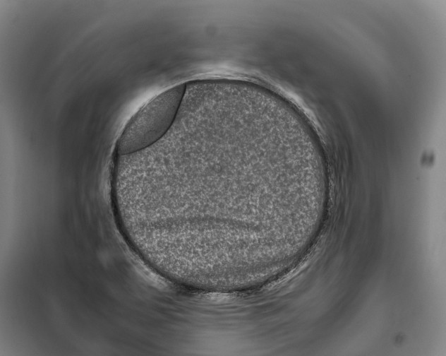 X0000099401463200806051156