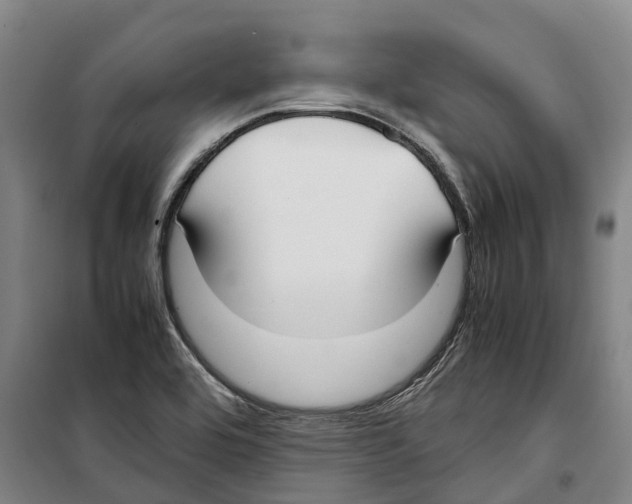 X0000099401464200806051156