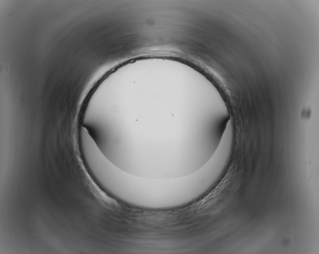X0000099401470200806051156