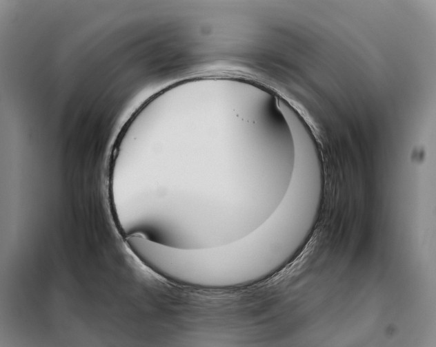 X0000099401478200806051156