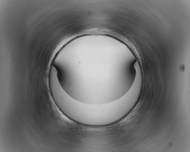 X0000099401486200806051156