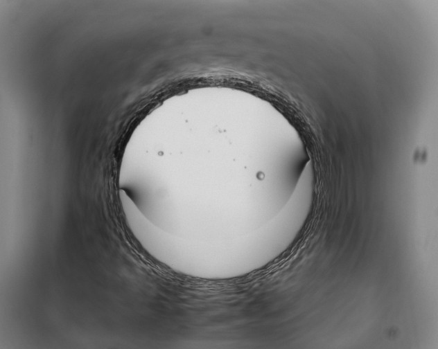 X0000099401493200806051155