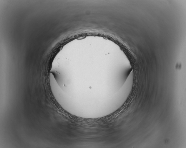 X0000099401495200806051155