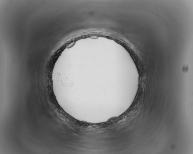 X0000099401496200806051155