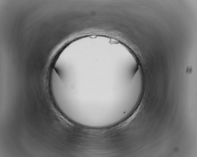 X0000099401502200806051155