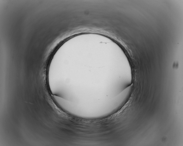 X0000099401503200806051155