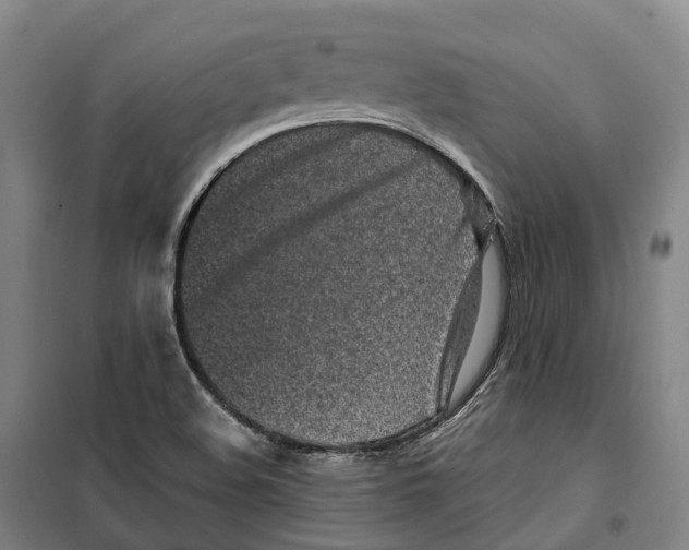 X0000099401508200806051155