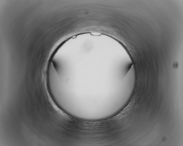 X0000099401515200806051156