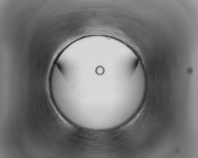 X0000099401517200806051156