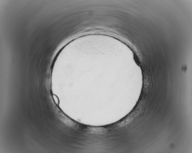 X0000099401522200806051156
