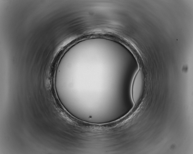 X0000099411018200805090722