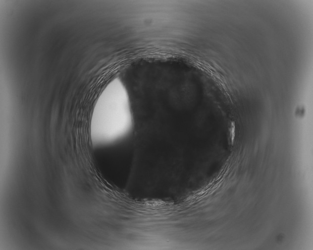 X0000099411059200805090722