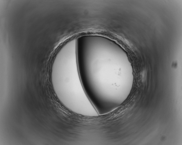 X0000099411160200805090720