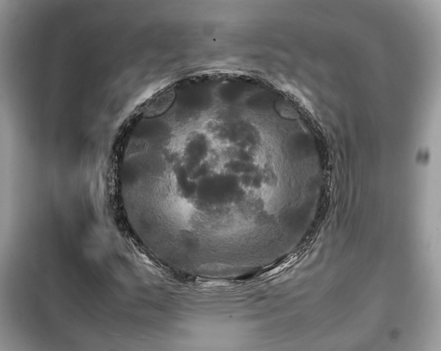 X0000099411159200805091212