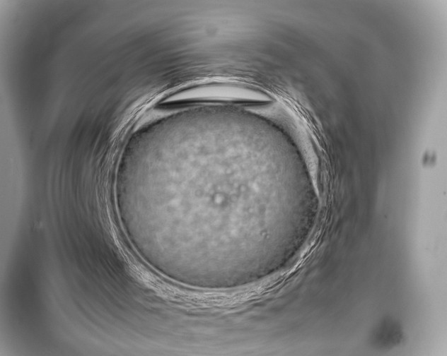 X0000099410001200805161033