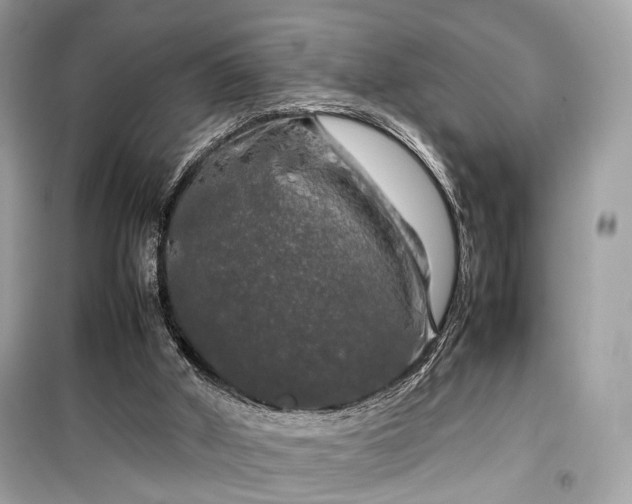 X0000099410010200805161033