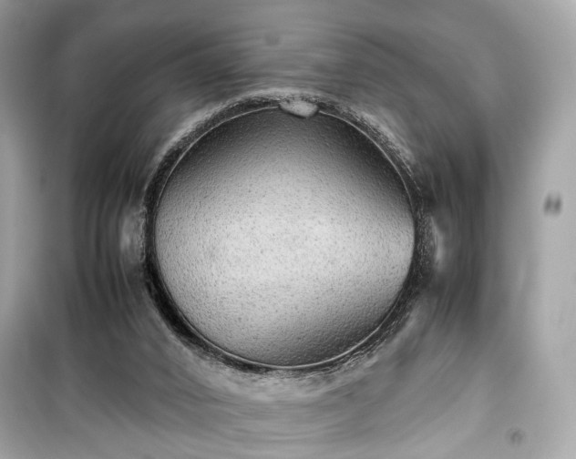 X0000099410016200805161033