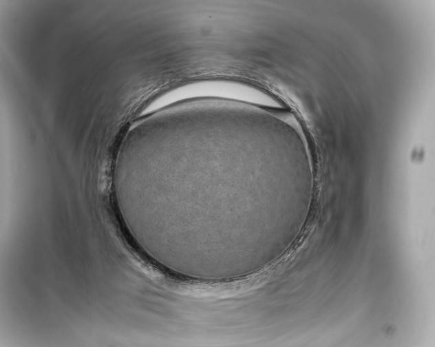 X0000099410017200805161033