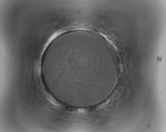 X0000099410056200805161032