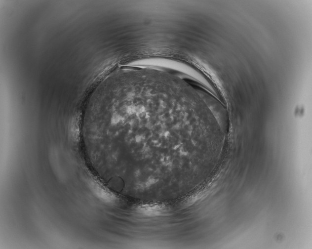 X0000099410065200805161032