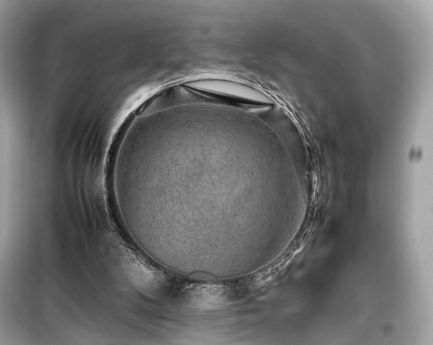 X0000099410104200805161031