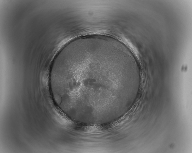 X0000099410107200805161031