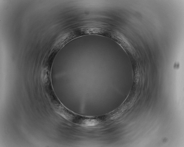 X0000099410169200805161030