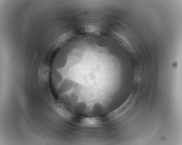 X0000099410171200805161030