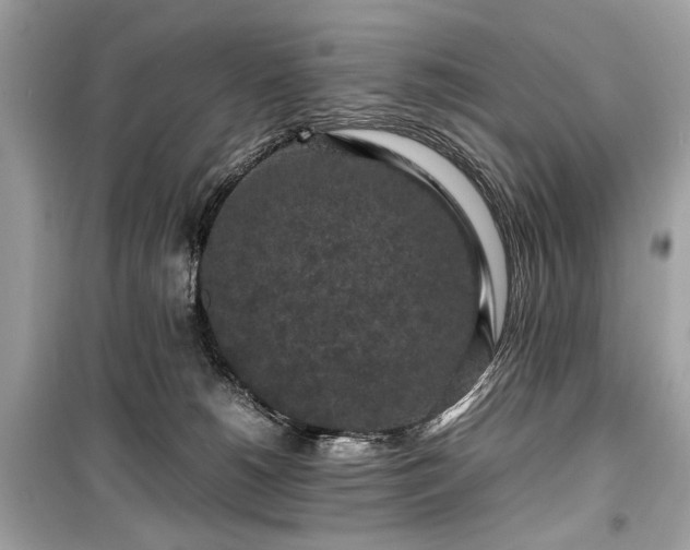 X0000099410180200805161031