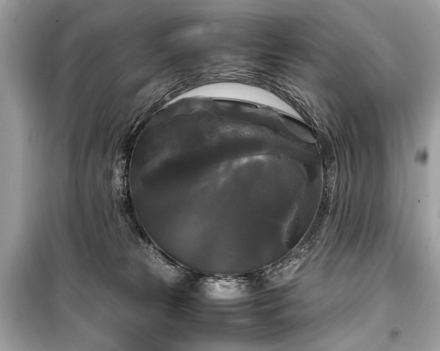 X0000099410181200805161031